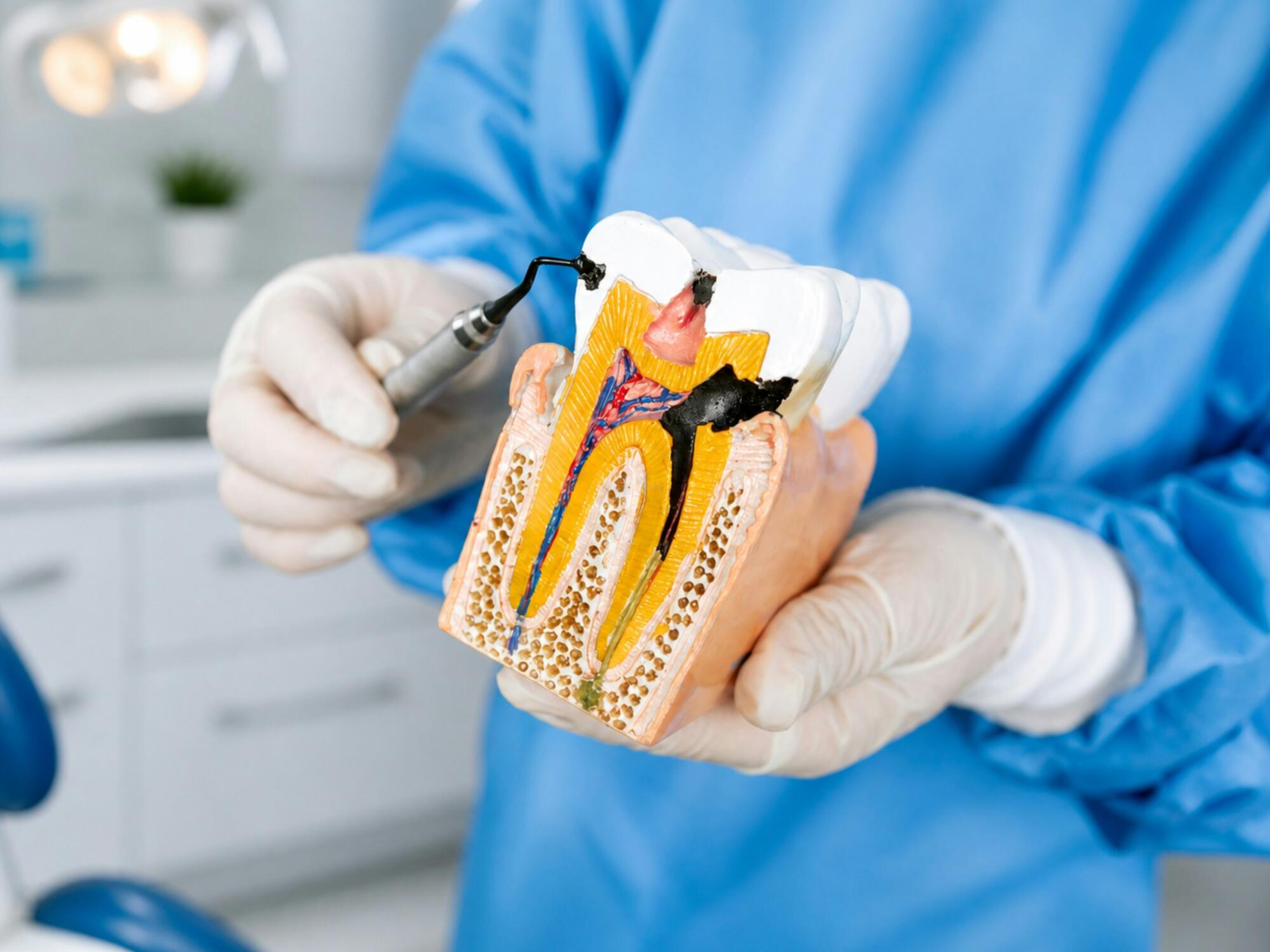 Why your body cannot naturally heal infections inside a tooth